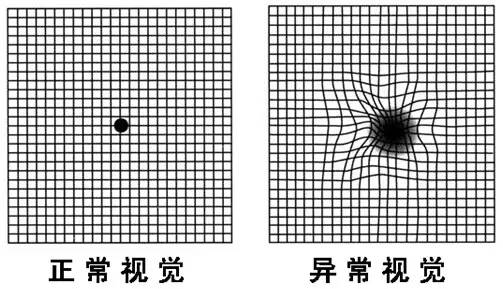 Led照明中藍(lán)光危害，尤其是對(duì)兒童。